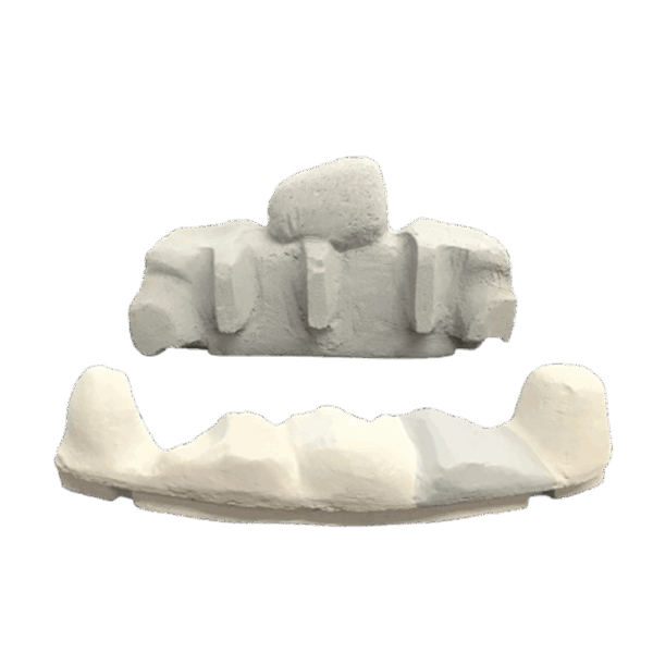 Valor 5108537 Ceramic Pebble Set C2- Obsolete